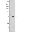 Western blot analysis of MAPRE2 expression in  CEM cell line lysate ,The lane on the left is treated with the antigen-specific peptide.