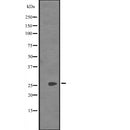 Western blot analysis of SYCP3 expression in Jurkat cell lysate,The lane on the left is treated with the antigen-specific peptide.