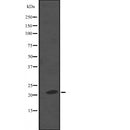 Western blot analysis of NKIRAS2 expression in  A549 whole cell lysate ,The lane on the left is treated with the antigen-specific peptide.