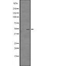 Western blot analysis of CREB3L3 expression in  IMR32 whole cell lysate ,The lane on the left is treated with the antigen-specific peptide.