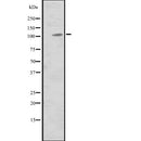 Western blot analysis of MIB2 expression in  Hela cell lysate,The lane on the left is treated with the antigen-specific peptide.