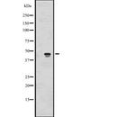 Western blot analysis of ALKBH5 expression in  293 cell line lysate ,The lane on the left is treated with the antigen-specific peptide.
