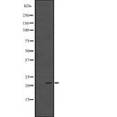Western blot analysis of extracts from Mouse  kidney, using BCL7B Antibody. The lane on the left was treated with blocking peptide.