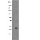 Western blot analysis of BCL7C expression in  Jurkat whole cell lysate.