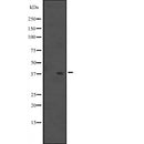 Western blot analysis of MUL1 expression in A431 whole cell lysate ,The lane on the left is treated with the antigen-specific peptide.