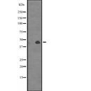 Western blot analysis of CANT1 expression in  Jurkat cell line lysates,The lane on the left is treated with the antigen-specific peptide.