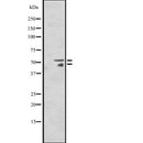 DF2592 staining HepG2 by IF/ICC. The sample were fixed with PFA and permeabilized in 0.1% Triton X-100,then blocked in 10% serum for 45 minutes at 25¡ãC. The primary antibody was diluted at 1/200 and incubated with the sample for 1 hour at 37¡ãC. An  Alexa Fluor 594 conjugated goat anti-rabbit IgG (H+L) Ab, diluted at 1/600, was used as the secondary antibod