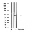 Western blot analysis of KLF12 expression in 293T whole cell lysate ,The lane on the left is treated with the antigen-specific peptide.