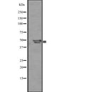 Western blot analysis of SP5/8/9 expression in  Mouse liver ti 721_B whole cell lysate ;,The lane on the left is treated with the antigen-specific peptide.