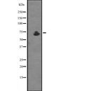 Western blot analysis of extracts from Mouse lung, using ZDHHC17 Antibody. The lane on the left was treated with blocking peptide.