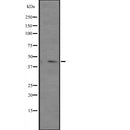 Western blot analysis of PAX4 expression in  Jurkat cell lysate ,The lane on the left is treated with the antigen-specific peptide.