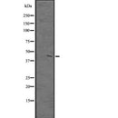 Western blot analysis of PKNOX1 expression in A431 whole cell lysate ,The lane on the left is treated with the antigen-specific peptide.