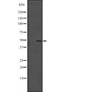 Western blot analysis of SOX4 expression in  Hela cell lysate,The lane on the left is treated with the antigen-specific peptide.