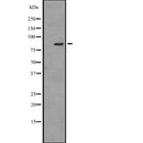 Western blot analysis of ZBTB16 expression in HL60 (Human promyelocytic leukemia cell line) Whole Cell Lysate,The lane on the left is treated with the antigen-specific peptide.