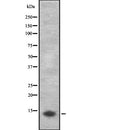 Western blot analysis of Cytochrome P450 3A43 expression in HEK293 cells ,The lane on the left is treated with the antigen-specific peptide.