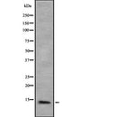 Western blot analysis of Cytochrome P450 3A43 expression in HEK293 cells ,The lane on the left is treated with the antigen-specific peptide.