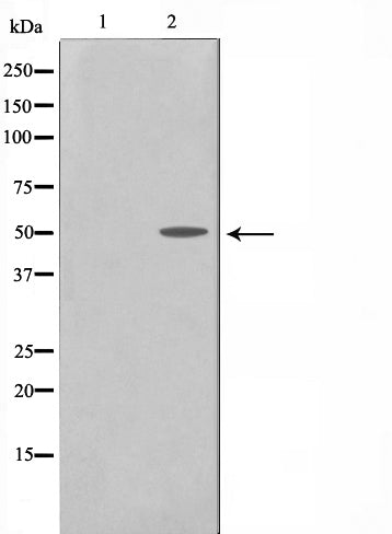 Western blot analysis on SK-OV3 cell lysate using Cyclin A1 Antibody,The lane on the left is treated with the antigen-specific peptide.