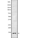 Western blot analysis of Cytochrome P450 3A43 expression in HEK293 cells ,The lane on the left is treated with the antigen-specific peptide.