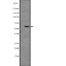 DF2621 at 1/100 staining Mouse kidney tissue by IHC-P. The sample was formaldehyde fixed and a heat mediated antigen retrieval step in citrate buffer was performed. The sample was then blocked and incubated with the antibody for 1.5 hours at 22¡ãC. An HRP conjugated goat anti-rabbit antibody was used as the secondary