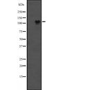 Western blot analysis of SIRT1 expression in  Jurkat cell lysate,The lane on the left is treated with the antigen-specific peptide.