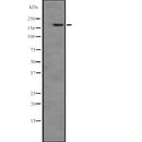 Western blot analysis of extracts from HepG2, using PIK3C2A Antibody.