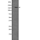 DF2624 at 1/100 staining Mouse kidney tissue by IHC-P. The sample was formaldehyde fixed and a heat mediated antigen retrieval step in citrate buffer was performed. The sample was then blocked and incubated with the antibody for 1.5 hours at 22¡ãC. An HRP conjugated goat anti-rabbit antibody was used as the secondary