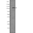 Western blot analysis of PIK3CB expression in Jurkat cell lysate,The lane on the left is treated with the antigen-specific peptide.