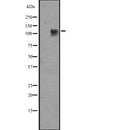 Western blot analysis of PIK3CD expression in Jurkat cell lysate,The lane on the left is treated with the antigen-specific peptide.