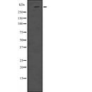Western blot analysis of HUWE1 expression in  293T whole cell lysate ,The lane on the left is treated with the antigen-specific peptide.