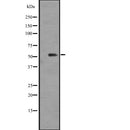 Western blot analysis of PIK3R3 expression in A A431 whole cell lysate ,The lane on the left is treated with the antigen-specific peptide.