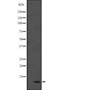 Western blot analysis of DYNLL1 expression in  Hela cell lysate,The lane on the left is treated with the antigen-specific peptide.