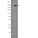 DF2632 at 1/100 staining Human lymph node tissue by IHC-P. The sample was formaldehyde fixed and a heat mediated antigen retrieval step in citrate buffer was performed. The sample was then blocked and incubated with the antibody for 1.5 hours at 22¡ãC. An HRP conjugated goat anti-rabbit antibody was used as the secondary