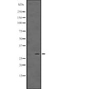 Western blot analysis of ING5 expression in  HepG2 whole cell lysate ,The lane on the left is treated with the antigen-specific peptide.