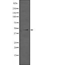 Western blot analysis of ING1 expression in  Hela cell lysate,The lane on the left is treated with the antigen-specific peptide.