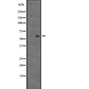 Western blot analysis of HRB expression in AGFG1 transfected 293T cells,The lane on the left is treated with the antigen-specific peptide.