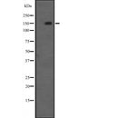 DF2640 at 1/100 staining Mouse liver tissue by IHC-P. The sample was formaldehyde fixed and a heat mediated antigen retrieval step in citrate buffer was performed. The sample was then blocked and incubated with the antibody for 1.5 hours at 22¡ãC. An HRP conjugated goat anti-rabbit antibody was used as the secondary