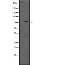 DF2642 at 1/100 staining Human liver cancer tissue by IHC-P. The sample was formaldehyde fixed and a heat mediated antigen retrieval step in citrate buffer was performed. The sample was then blocked and incubated with the antibody for 1.5 hours at 22¡ãC. An HRP conjugated goat anti-rabbit antibody was used as the secondary