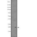 Western blot analysis of CIRBP expression in  HCT116 whole cell lysate ,The lane on the left is treated with the antigen-specific peptide.