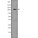 Western blot analysis of RASA1 expression in  Hela cell lysate,The lane on the left is treated with the antigen-specific peptide.