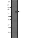 Western blot analysis of RASEF expression in  K-562 cell lysate at 25ug/lane.,The lane on the left is treated with the antigen-specific peptide.