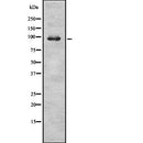 Western blot analysis of RASA2 expression in HEK293 cells ,The lane on the left is treated with the antigen-specific peptide.