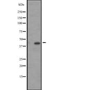 Western blot analysis of ACTA1/A2/C1 expression in A431 whole cell lysate ,The lane on the left is treated with the antigen-specific peptide.