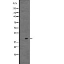Western blot analysis of POMC expression in ; HepG2 cell lysate,The lane on the left is treated with the antigen-specific peptide.