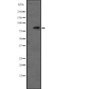 Western blot analysis of PTK7 expression in HEK293 cells ,The lane on the left is treated with the antigen-specific peptide.