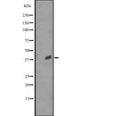 Western blot analysis of CCRK expression in  RPMI-8226 cell lysate ;;,The lane on the left is treated with the antigen-specific peptide.