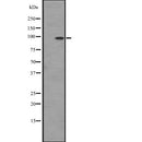 Western blot analysis of DDR2 expression in  Hela cell lysate,The lane on the left is treated with the antigen-specific peptide.