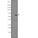 DF2665 at 1/100 staining Mouse spleen tissue by IHC-P. The sample was formaldehyde fixed and a heat mediated antigen retrieval step in citrate buffer was performed. The sample was then blocked and incubated with the antibody for 1.5 hours at 22¡ãC. An HRP conjugated goat anti-rabbit antibody was used as the secondary