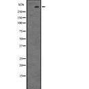 Western blot analysis of LRRK2 expression in HEK293 cells ,The lane on the left is treated with the antigen-specific peptide.
