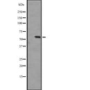 Western blot analysis of PCTK3 expression in A431 whole cell lysate ,The lane on the left is treated with the antigen-specific peptide.