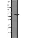 Western blot analysis of extracts from Hela, using PRKCI Antibody. Lane 1 was treated with the blocking peptide.